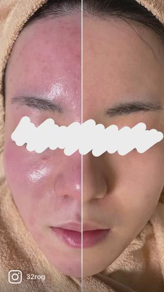 ビフォーアフター 