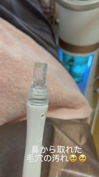 鼻から取れた毛穴の汚れ

こんなに汚れ溜まってたら
高い化粧水も意味ない！
マスク外す前にぜひ 