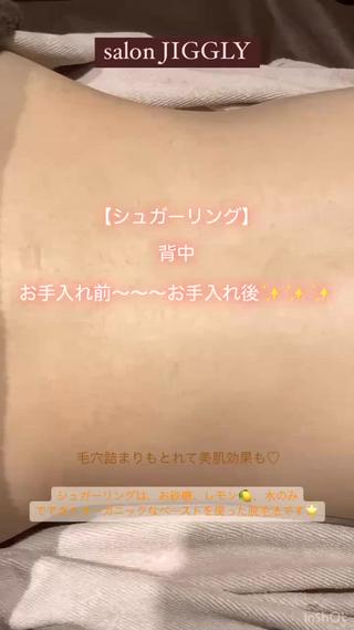 シュガーリング 