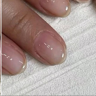 育爪ジェルコース
3ヶ月間、4回ご来店でのお写真です。

通常のジェルコースより、お爪が育つようにしっかりとケアをさせていただき、オイルでのホームケアをしていただくことで美爪に育てることができます

お爪の形を変えていきたい方にお勧めです 