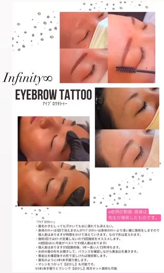 ｱｲﾌﾞﾛｳﾀﾄｩｰ
★眉毛をかいても汗をかいても水に濡れてもきえない
★身体のﾀﾄｩｰは一生懸命消えませんがｱｲﾌﾞﾛｳﾀﾄｩｰは身体のﾀﾄｩｰより浅い層に施術を致しますので時間をかけて消えていきます
なので形は後に変えることができます
★施術1回ではｶﾗｰの定着がしませんので2回または3回の施術をオススメします
※2回は1回目の1ヶ月〜1ヶ月半後です。　
★2回･3回施術後ｶﾗｰが定着した後は1年〜2年長い人でそれ以上持ちます
★眉毛の形はお好きな形をお聞きしバランスを確認しながら黄金比書きお客様に確認して頂きます
【上記全て個人差はがございますのでご了承ください】

 