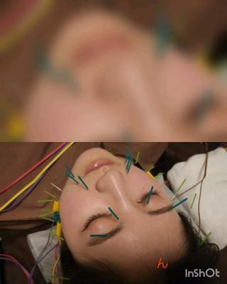 オーダーメイド美鍼-BIJIN-（全身＋お顔） 