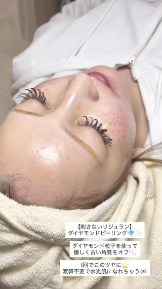 ダイヤモンドピーリング 