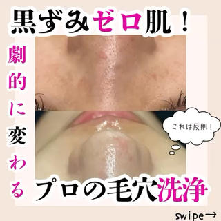 ＠carena_azabujuban 本店のシャワースキンメソッドをご紹介させて頂きます。
シャワースキンメソッドによる水流吸引で、毛穴の奥の汚れや皮脂、老化角質を除去後、
お肌に合わせた美容成分を針のない水光ジェット
特殊マイクロチップにより皮膚の表層～深層まで浸透させます。
そうする事により、毛穴汚れ除去後の開いてしまった毛穴が塞がって行くのです。
いかにお肌に負担をかけずに毛穴汚れを除去し、なかった事にするのがプロの技
関西でシャワースキンメソッドを体感できるのは@carena_umeda 店のみ
予約の取れないお店になる前にぜひ一度ご体感下さい 