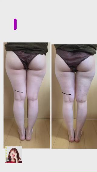 痩身/脱毛/ネイル HARUKAのエステ・リラクイメージ