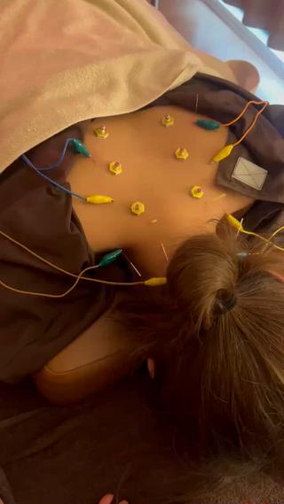  首・肩こりがつらいあなたに

鍼＋パルスで深部の筋肉までじんわりアプローチ️

デスクワークやスマホ疲れでガチガチになった首や肩…。
そんなお悩みにおすすめなのが、
鍼に微弱電流（パルス）を流す施術です！

 表面では届かない深いコリにアプローチ
 筋肉がやさしく動かされて血流UP
 重だるさ・こり感をスッキリ解放！

痛みはほとんどなく、心地よいリズムでじんわり効いてくる感覚です
はじめての方にもおすすめです◎
 