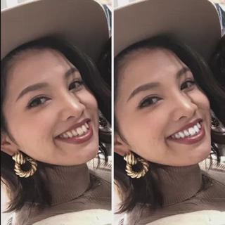 #セルフホワイトニング
#柏ホワイトニング 