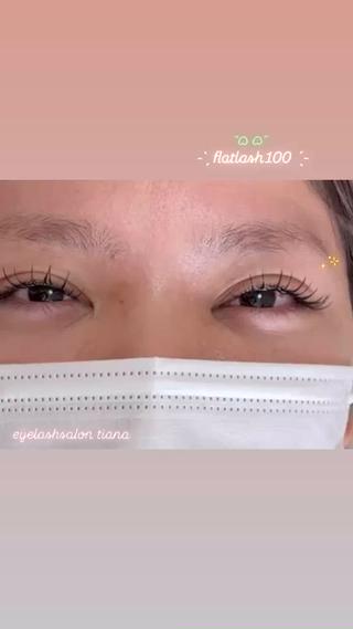 flatlash100 