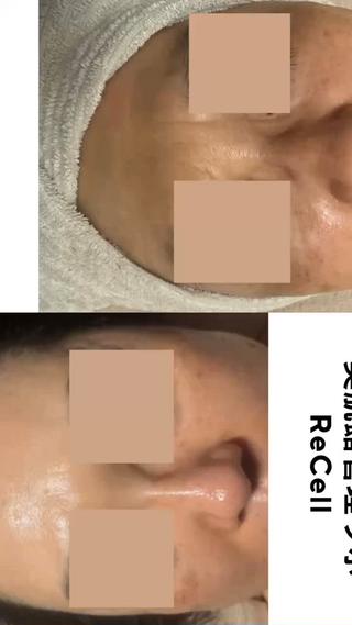 ReCell 肌管理のエステ・リラクイメージ