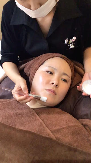 ラジオ波で小顔リフトアップ 