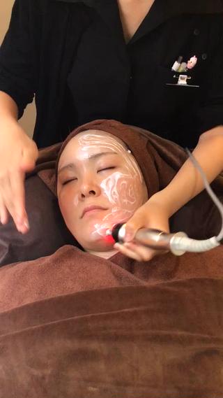 ラジオ波で小顔リフトアップ 