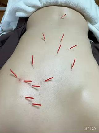 美容鍼・脱毛サロン Callaのエステ・リラクイメージ