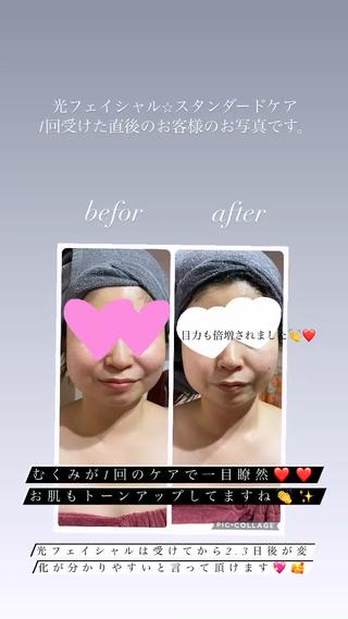 むくみがとれスッキリされ、お肌のトーンアップしたお客様♡ 