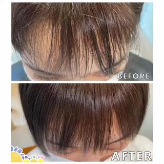 実際にご来店頂いたお客様です。
右目側の浮くクセと、うねりが他の場所よりもつよくありましたが
綺麗になりました。
前髪専用のお薬を使っているので、優しく、自然な仕上がりになりました。
ありがとうございました。 
