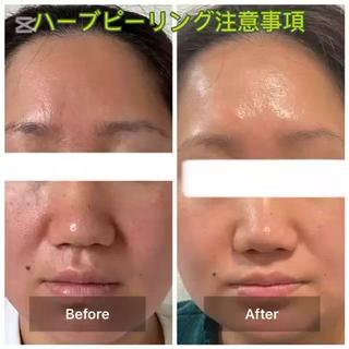 ハーブピーリング 専門店MOKA所属・ハーブピーリング専門 MOKAのエステ・リラクイメージ