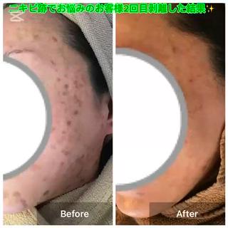 ハーブピーリング 専門店MOKA所属・ハーブピーリング専門 MOKAのエステ・リラクイメージ