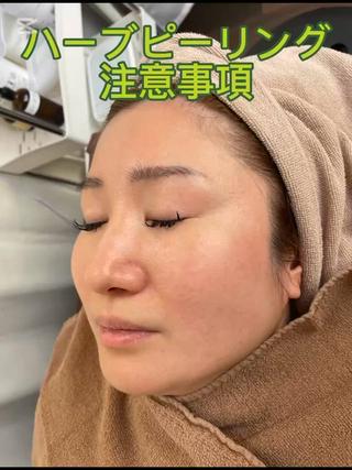 ハーブピーリング 専門店MOKA所属・ハーブピーリング専門 MOKAのエステ・リラクイメージ