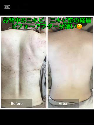 ハーブピーリング 専門店MOKA所属・ハーブピーリング専門 MOKAのエステ・リラクイメージ