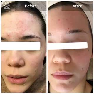 ハーブピーリング 専門店MOKA所属・ハーブピーリング専門 MOKAのエステ・リラクイメージ