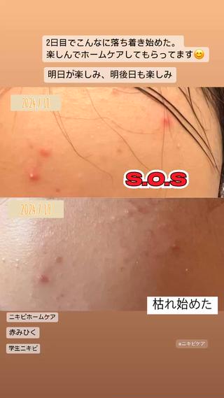 🅖🅤🅩🅔🅛 salonのエステ・リラクイメージ