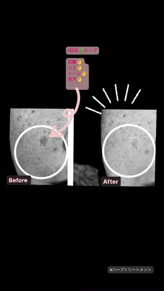 🅖🅤🅩🅔🅛 salonのエステ・リラクイメージ