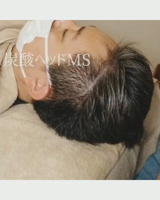 ヘッドエステでは、オプション＋500円でシュワシュワぱちぱちの炭酸ヘッドコースにグレードアップできます 