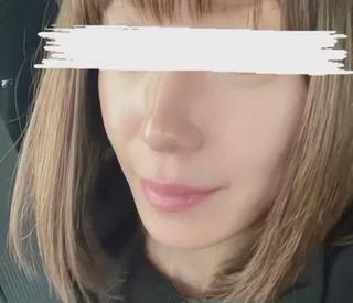 痛みなし.剥げない.ダウンタイムなし！の
ハーブピーリングは、REVI以外にもございますが
何故、REVIがこんなに人気なのか...
効果を発揮するのか！？

それは、施術に使用する商材にも！ホームケアにも！
全てに入っている植物幹細胞成分が素晴らしいのです！！

️リンゴ幹細胞
腐らないと言われているスイス産の希少なリンゴから抽出したエキス。

️ぶどう幹細胞
紫外線に強い希少なフランス産赤ブドウから抽出したエキス。

️アルガン幹細胞
世界で最も古い樹木種である希少なモロッコ産アルガンツリーから抽出したエキス。

食物幹細胞エキスが皮膚幹細胞を活性化してくれます。

 