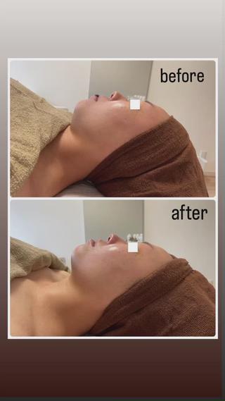 初めての陶肌トリートメントで
お顔がスッキリ

艶々なお肌にもなりお喜び頂けました
 