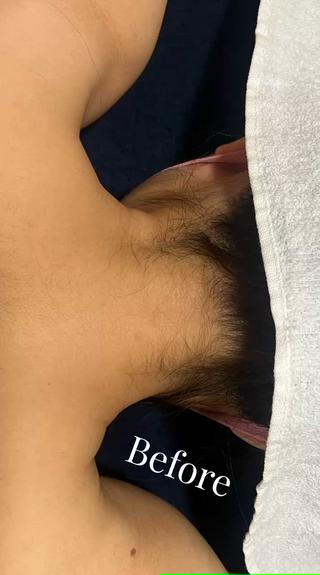 どの箇所でも料金が一緒！
うなじ・背中は無料シェービング付きです︎
意外と他人にみられているうなじが
人気箇所となっております 