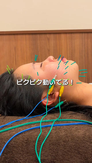 初めての方もお任せ下さい

50本でも多いと感じる方は本数を減らすことも可能です！
1番大切なのは、リラックスして受けること
緊張したまま受けても逆に疲れてしまって
効果がよくわからない…

慣れてきたら少しずつ増やしていくのも〇

小顔と美肌に特化した美容鍼専門サロンで
美容鍼デビューしてみませんか？ 