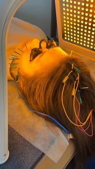 小顔美容鍼専門サロン 渋谷YZのエステ・リラクイメージ