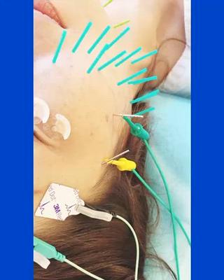 電気のチカラでリフトアップ♪

・ほうれい線
・口角
・エラ
・たるみ
・むくみ 