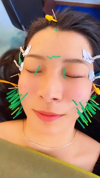 デカ目・口角アップ・エラ撃退には本当にオススメ◎ 