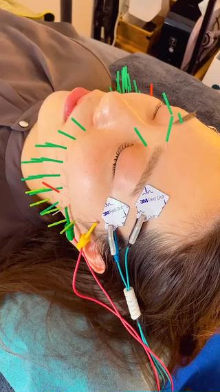 電気の刺激が心地良いと大人気！ 