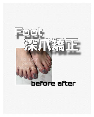 関東にお引っ越しされたのにご来店くださったお客さま
もうお会い出来ないと思っていたので嬉しすぎました
実はご予約くださった時点でひとりだいぶ喜んでました

自爪がゆっくり伸びてきているので足りないところの長さを出しつつ 活かせるところはそのまま自爪にジェルを施しました(˙꒳˙ )
たくさんお話できて楽しかったです
またいつでも息抜きにきてください！
ありがとうございました 