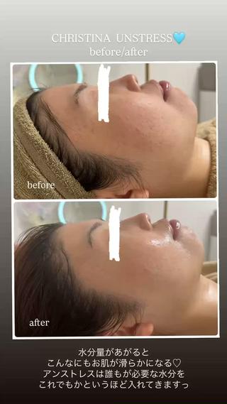 アンストレス　ビフォー/アフター 
