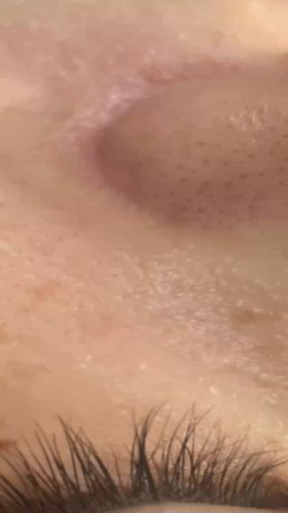 ハイドロピーリングコース！！
ワントーン上がり、お肌はツルツルにꕤ︎︎·͜·
お客様からも「つるつる️」と喜びのお声頂いております*゜ 