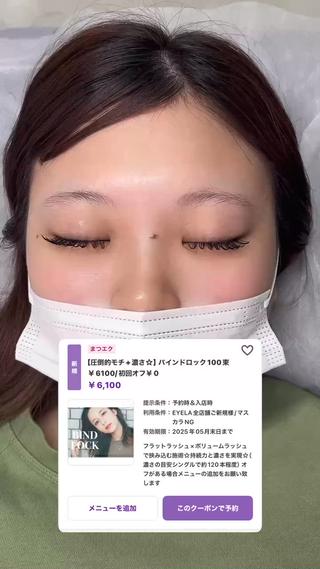 バインドロック100束 