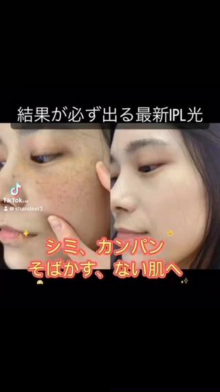 シミ、カンパン、そばかすもう悩まない!