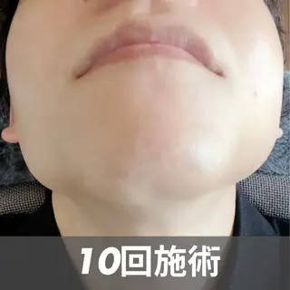 メンズ GLOW by MKのエステ・リラクイメージ