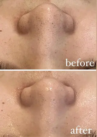 RAY Beauty エステ　一宮店のエステ・リラクイメージ