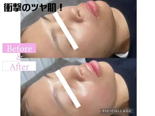 カンナムビューティー 新宿🦋碧.aoiのエステ・リラクイメージ