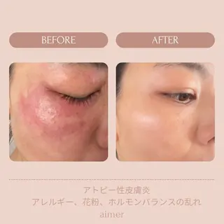 aimer beautyのエステ・リラクイメージ