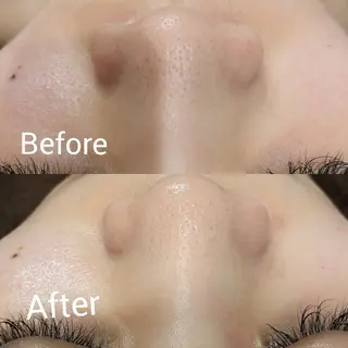 ﾌｪｲｼｬﾙｴｽﾃ ﾗﾄｩｰﾙ伊深のエステ・リラクイメージ