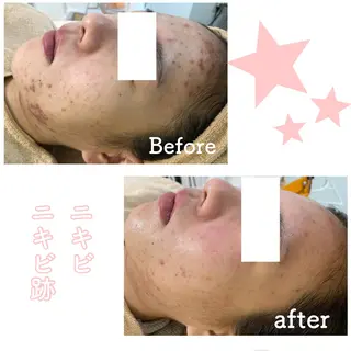 ショート カラー パーマ ヘアアレンジ メンズ キッズ ネイル マツエク・マツパ ニキビ&跡改善サロン オーナー光木のエステ・リラクイメージ