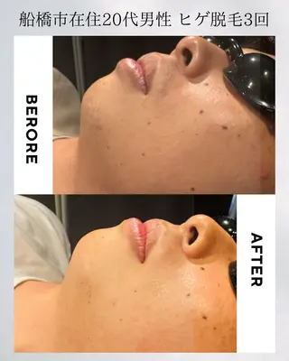 都度払いメンズGents.FUNABASHI 東船橋店所属・東船橋メンズ脱毛 ジェンツ船橋のエステ・リラクイメージ