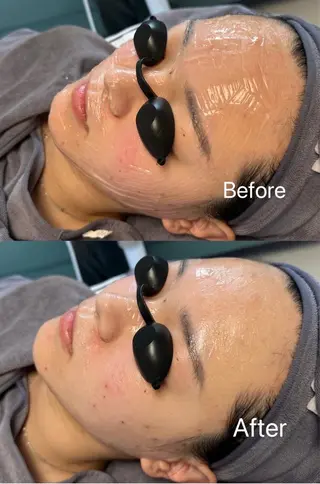 韓国式肌管理＆毛穴洗浄　THE ONE栄店所属・Theone 福本のエステ・リラクイメージ