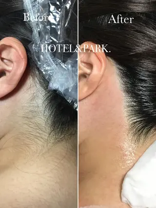 HOTEL&PARK . ワックス脱毛のエステ・リラクイメージ