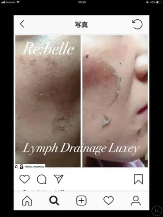 【リベルハーブピーリング認定店】敏感肌・美白脱毛専門店Dione立川店所属・Dione 立川店のエステ・リラクイメージ