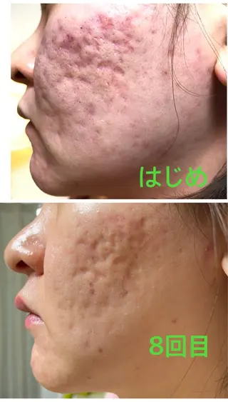 横浜ビューティーファクトリーHANA元町店所属・エステ＆アロマ HANAのエステ・リラクイメージ